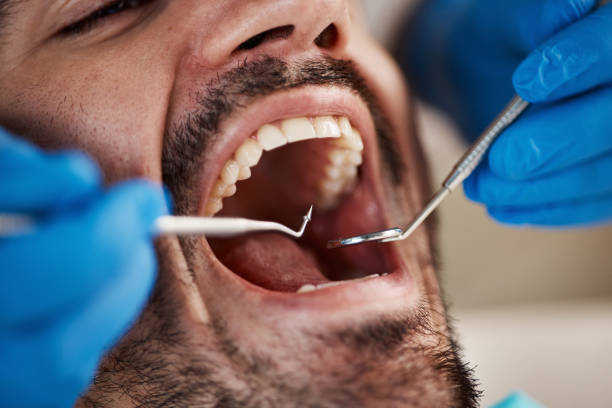 Best Emergency Dentist for Knocked-Out Tooth in Celina, TN