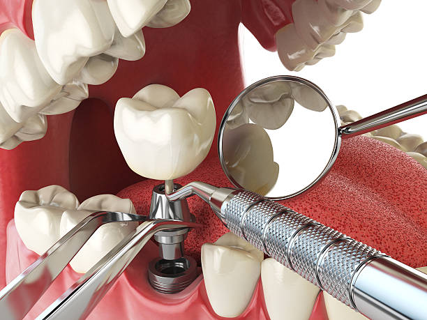 Best Pediatric Emergency Dentist in Celina, TN