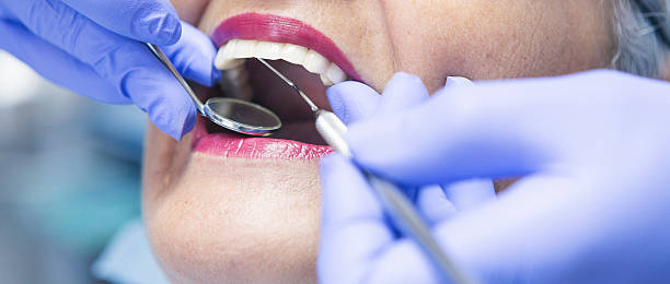 Best Emergency Dental Extractions in Celina, TN